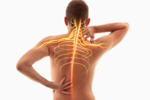 Neck Pain, nervous System Human Anatomy Spine And Neck Nerves